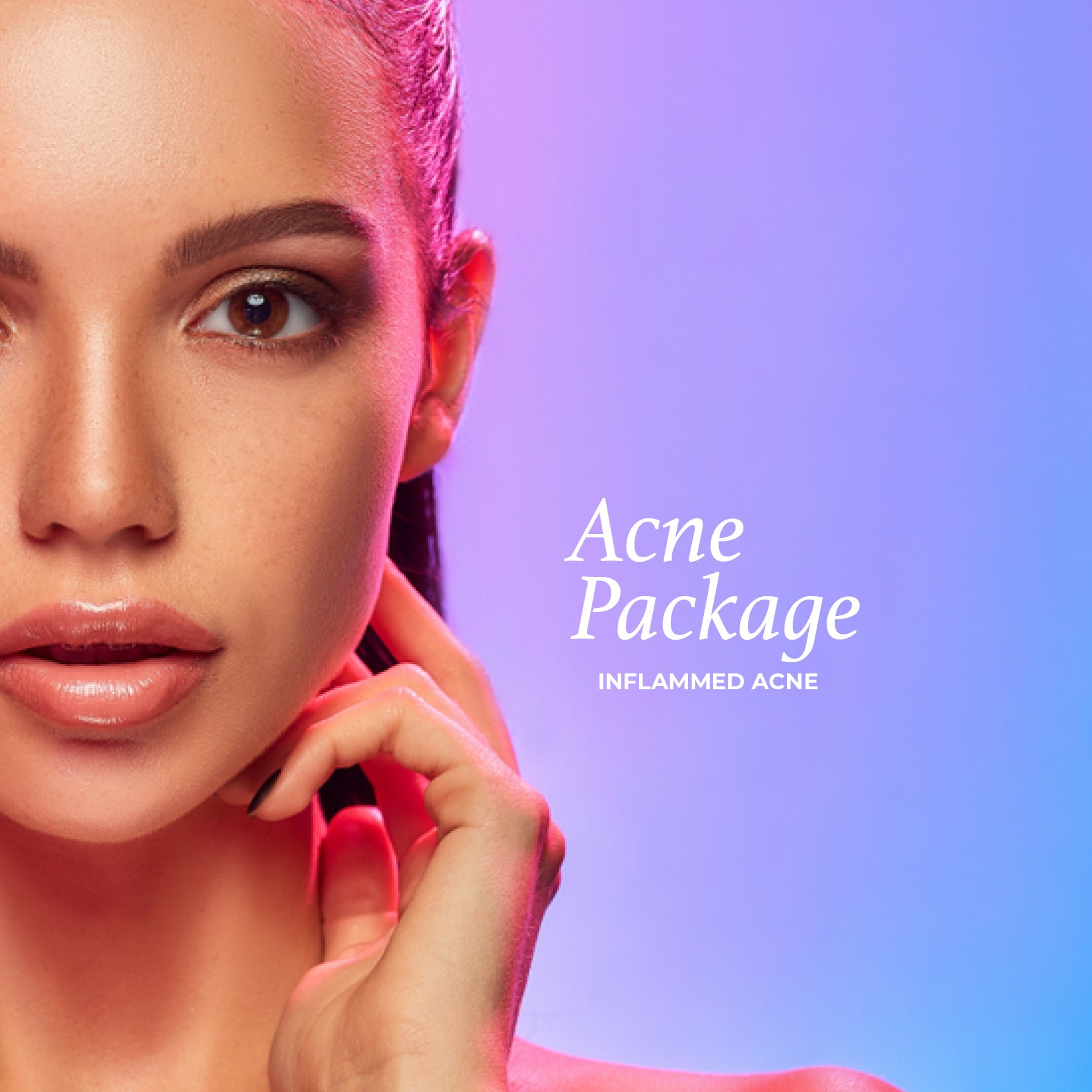 acne-package-inflamed-acne-pink-laser-clinics