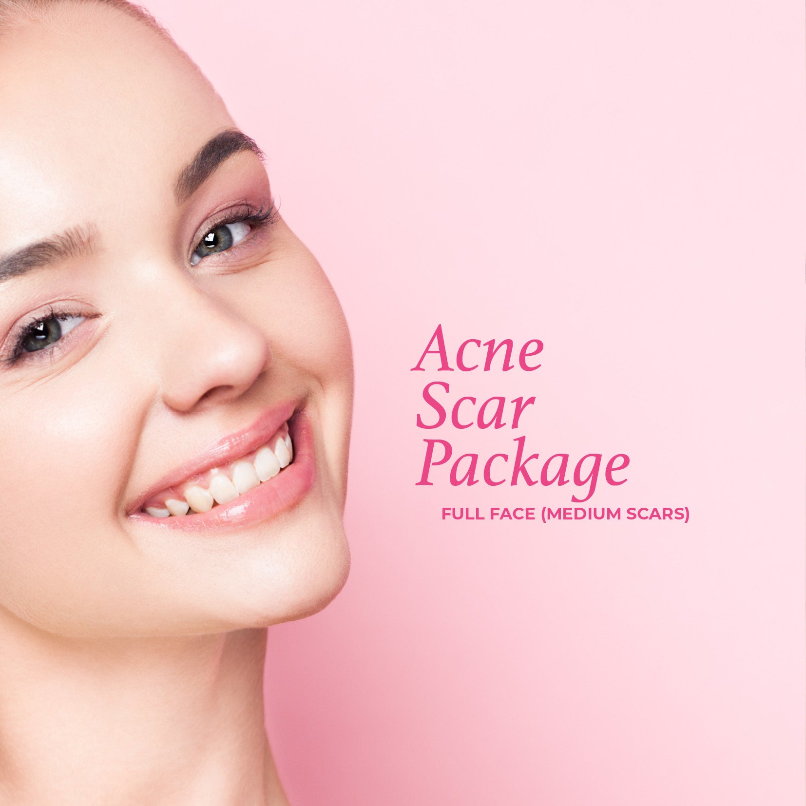 Acne Scar Package - Full Face (medium scars) – Pink Laser Clinics